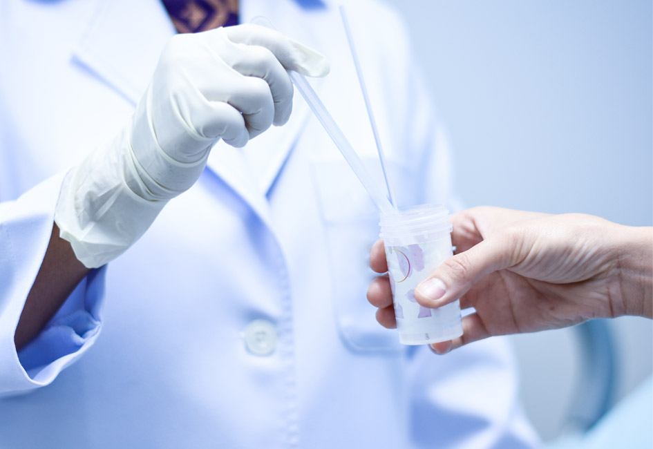 Analyse frottis dépistage HPV par un médecin